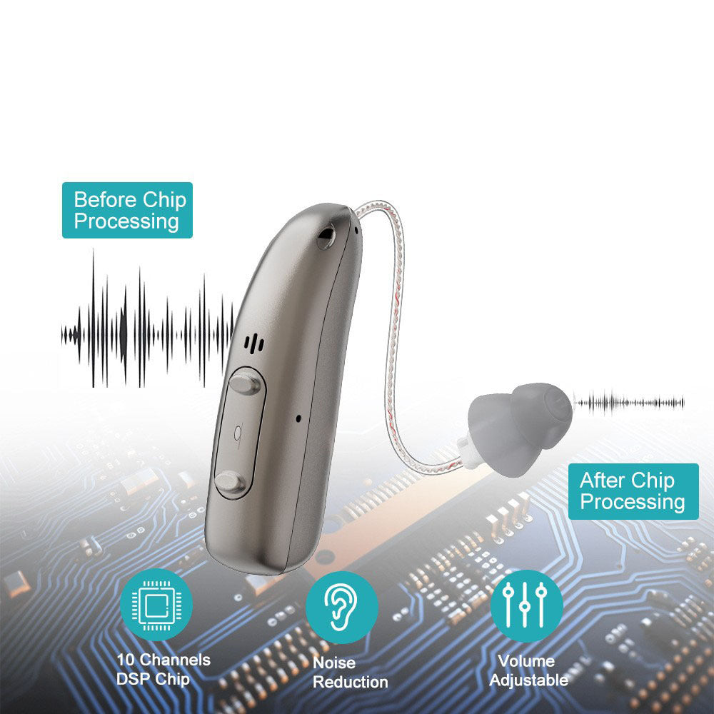 Aurora Tech™ Smart Sound Support – Hear Clearly Again | 60% OFF